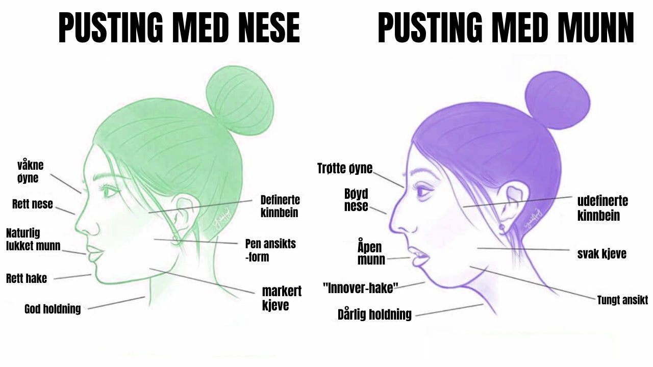 Munntape 30 stk (1 mnd)